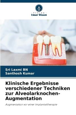 Klinische Ergebnisse verschiedener Techniken zur Alveolarknochen-Augmentation - Sri Laxmi Bn,Santhosh Kumar - cover