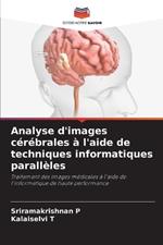 Analyse d'images c?r?brales ? l'aide de techniques informatiques parall?les