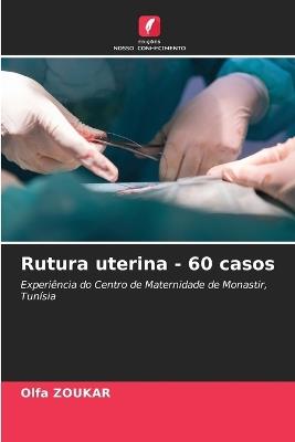 Rutura uterina - 60 casos - Olfa Zoukar - cover