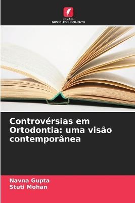 Controv?rsias em Ortodontia: uma vis?o contempor?nea - Navna Gupta,Stuti Mohan - cover