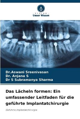 Das L?cheln formen: Ein umfassender Leitfaden f?r die gef?hrte Implantatchirurgie - Dr Aswani Sreenivasan,Anjana S,S Subramanya Sharma - cover