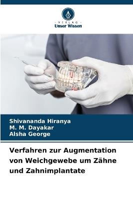 Verfahren zur Augmentation von Weichgewebe um Z?hne und Zahnimplantate - Shivananda Hiranya,M M Dayakar,Alsha George - cover