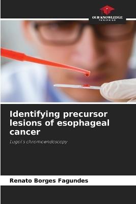 Identifying precursor lesions of esophageal cancer - Renato Borges Fagundes - cover