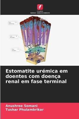 Estomatite ur?mica em doentes com doen?a renal em fase terminal - Anushree Somani,Tushar Phulambrikar - cover