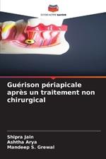 Gu?rison p?riapicale apr?s un traitement non chirurgical