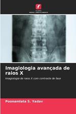 Imagiologia avan?ada de raios X