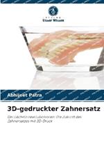 3D-gedruckter Zahnersatz