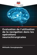 ?valuation de l'utilisation de la navigation dans les op?rations neurochirurgicales