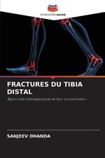 Fractures Du Tibia Distal