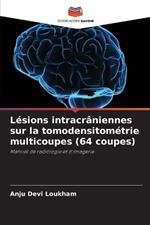 L?sions intracr?niennes sur la tomodensitom?trie multicoupes (64 coupes)