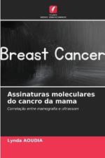 Assinaturas moleculares do cancro da mama