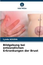 Bildgebung bei entz?ndlichen Erkrankungen der Brust