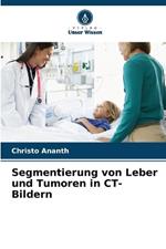 Segmentierung von Leber und Tumoren in CT-Bildern