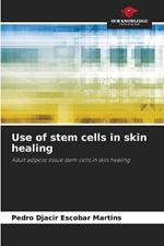 Use of stem cells in skin healing