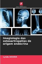 Imagiologia das osteoartropatias de origem end?crina