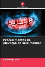 Procedimentos de eleva??o do seio maxilar