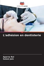 L'adh?sion en dentisterie