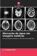 Marca??o de ?gua em imagens m?dicas