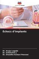 ?checs d'implants