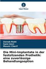 Die Mini-Implantate in der festsitzenden Prothetik: eine zuverlässige Behandlungsoption