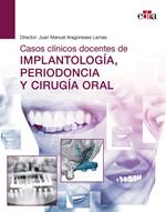 Casos clínicos docentes de IMPLANTOLOGÍA, PERIODONCIA Y CIRUGÍA ORAL