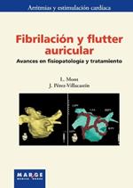 Fibrilación y flutter auricular