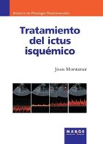 Tratamiento del ictus isquémico