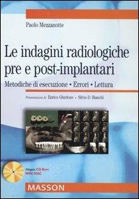 Le indagini radiologiche pre e post-implantari. Metodiche di esecuzione. Errori. Lettura - Paolo Mezzanotte - copertina