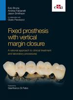 Fixed prosthesis with vertical margin closure