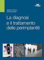 La diagnosi e il trattamento delle perimplantiti