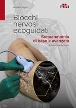 Blocchi nervosi ecoguidati. Sonoanatomia di base avanzata