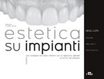 Estetica su impianti. Risolvere casi complessi nei settori anteriori con un approccio globale al sorriso del paziente