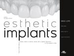 Esthetic implants. How to think about complex cases in anterior areas with a global approach to the patient' s smile