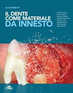 Il dente come materiale da innesto