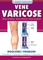 Vene varicose. Prevenire, ridurre ed elliminare