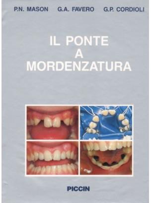 Il ponte a mordenzatura - P. Nicola Mason,G. Antonio Favero,G. P. Cordioli - 4