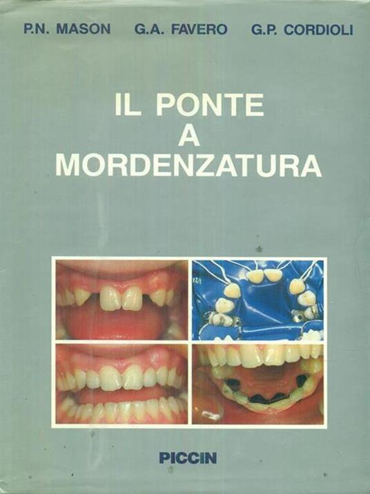 Il ponte a mordenzatura - P. Nicola Mason,G. Antonio Favero,G. P. Cordioli - copertina