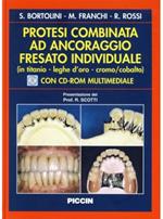 Protesi combinata ad ancoraggio fresato individuale (titanio, leghe d'oro, cromo, cobalto)