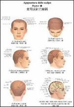 Tavole di agopuntura della scalpo