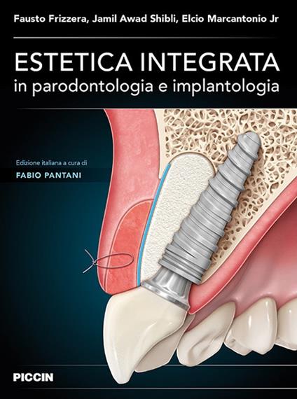 Estetica integrata in parodontologia e implantologia - Fausto Frizzera,Jamil Awad Shibli,Elcio Marcantonio Jr - copertina