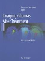 Imaging gliomas after treatment