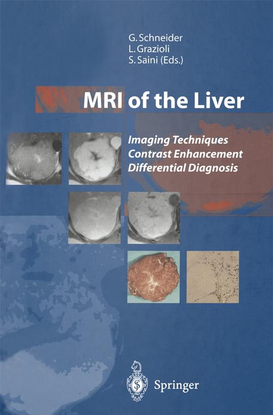 MRI of the Liver