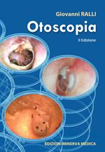 Otoscopia