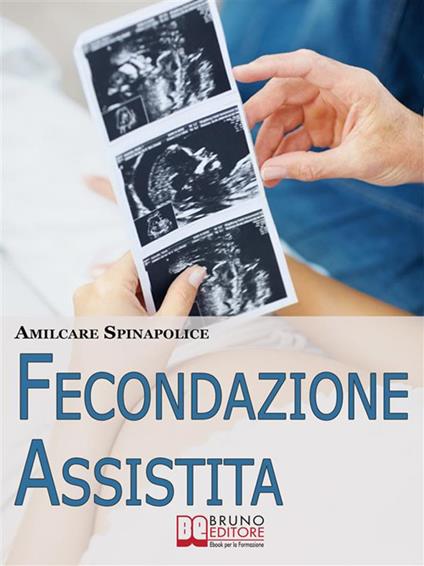 Fecondazione assistita - Amilcare Spinapolice - ebook