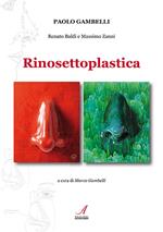 Rinosettoplastica