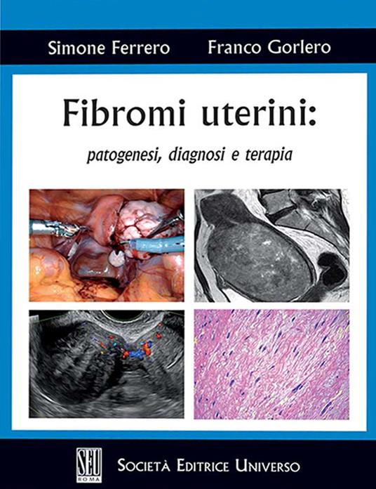 Fibromi