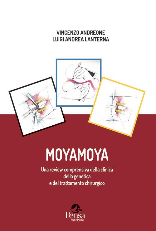 Moyamoya. Una review comprensiva della clinica della genetica e del trattamento chirurgico - Vincenzo Andreone,Luigi Andrea Lanterna - copertina