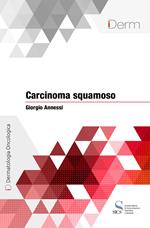 Carcinoma squamoso