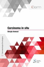 Carcinoma in situ