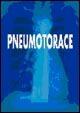 Pneumotorace - copertina